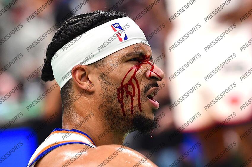 May 14, 2025; Boston, Massachusetts, USA; New York Knicks guard Josh Hart (3) is bloodied after taking an elbow to the eye in the first half during game five of the second round for the 2025 NBA Playoffs against the Boston Celtics at TD Garden. Mandatory Credit: Bob DeChiara-Imagn Images NBA: Playoffs-New York Knicks at Boston Celtics 
